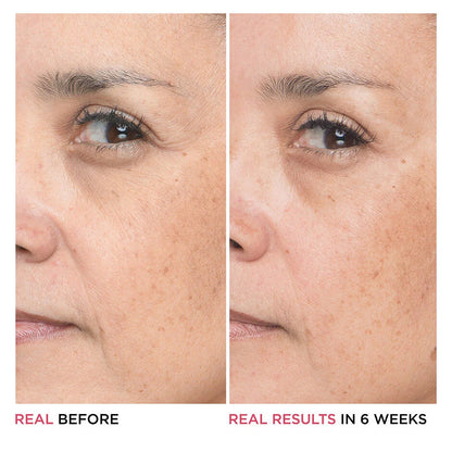 Bye Bye Lines Hyaluronic Acid Serum